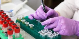 LGA RESPONDS TO LATEST TEST AND TRACE FIGURES