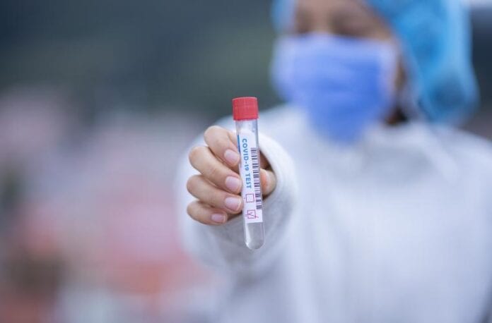 test-tube-5065424_1920
