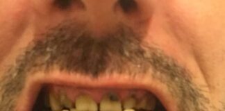 Gruesome grooming – 2.1 million Brits have never worn deodorant, and 500k have never brushed their teeth