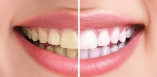 WORLD SMILE DAY: WHY YOU MAY ONLY BE CLEANING AROUND 60% OF YOUR TEETH