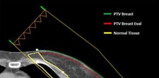 Royal College of Radiologists – New Wales-developed cancer training tool to increase quality of radiotherapy planning for patients and improve cancer outcomes