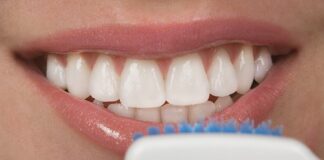 Got Your Porcelain Veneer? Learn About the Ways to Take Care About Them