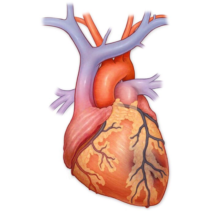 Myocardial-Infarction-An-Unavoidable-Risk