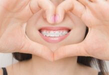 Straightening Smiles in Hereford: Your Guide to Orthodontic Care
